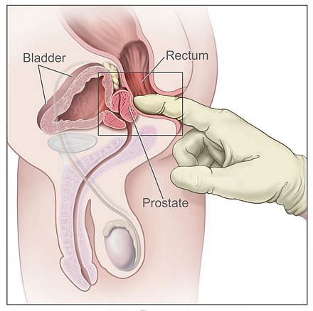 Uitleg over de prostaat